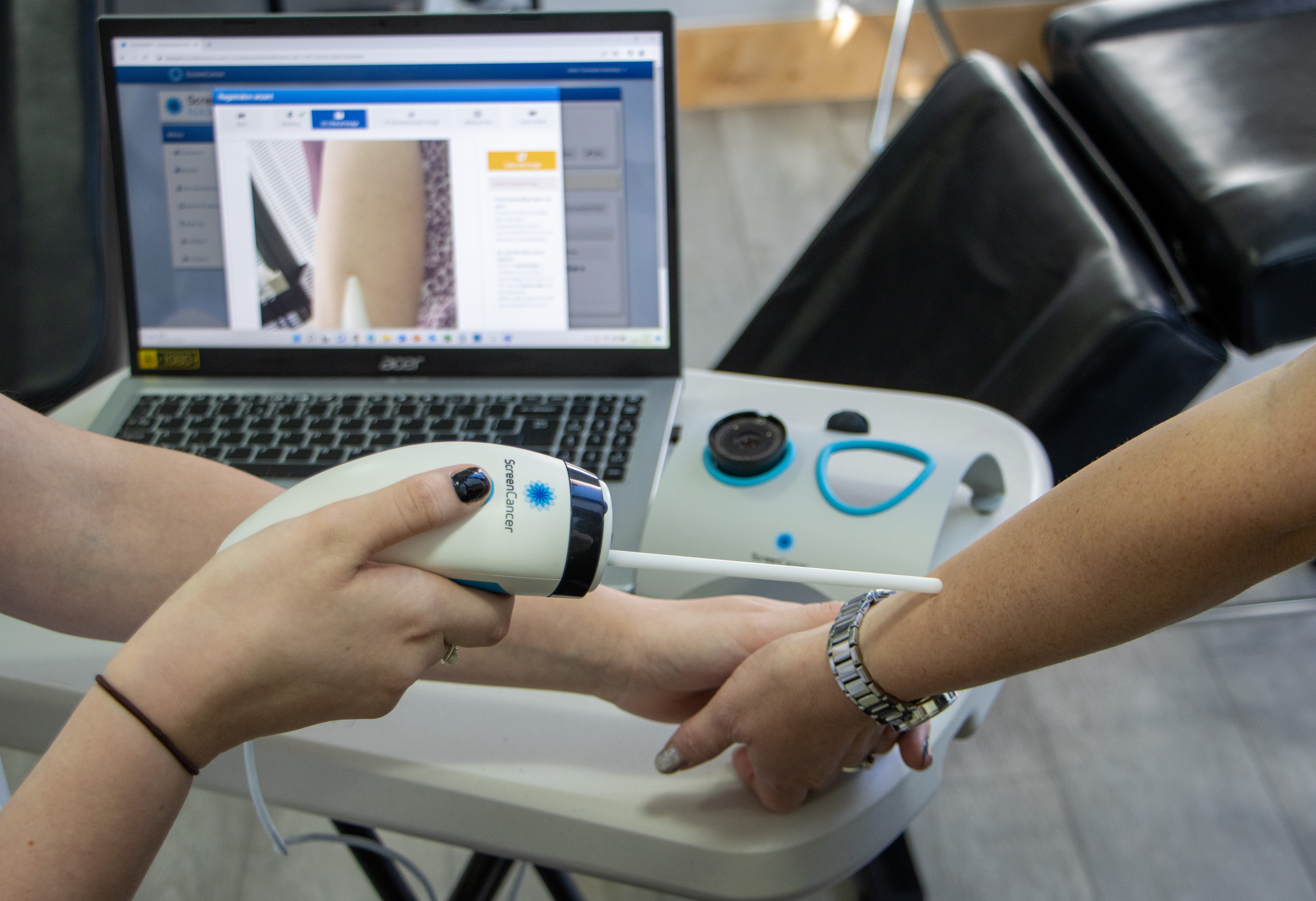 Scanning hand for moles