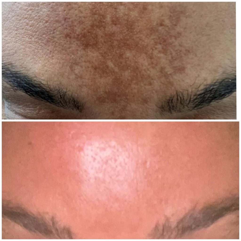 Before and after pictures
